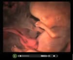 Pro-Abortion - Watch this short video clip